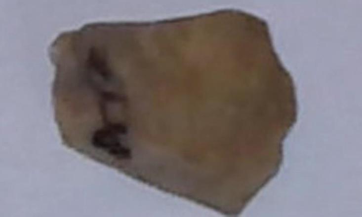 ..